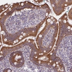 Immunohistochemical staining of human duodenum shows moderate granular cytoplasmic positivity in glandular cells.