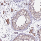 Immunohistochemical staining of human testis shows weak granular cytoplasmic positivity in Leydig cells and cells in seminiferous ducts.