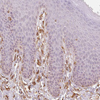 Immunohistochemical staining of human skin shows moderate cytoplasmic positivity in fibroblasts.