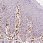 Immunohistochemical staining of human skin shows moderate cytoplasmic positivity in fibroblasts.