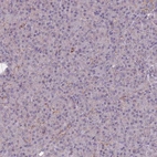 Immunohistochemical staining of human pancreas shows very weak granular cytoplasmic positivity in exocrine glandular cells.
