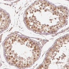 Immunohistochemical staining of human testis shows moderate to strong cytoplasmic an nuclear positivity in cells in seminiferous ducts.