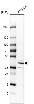 Western blot analysis in human cell line AN3-CA.