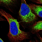 Immunofluorescent staining of human cell line U-2 OS shows localization to endoplasmic reticulum & vesicles.