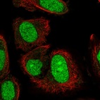 Anti-TRMT6 Antibody