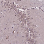 Anti-PNPLA5 Antibody