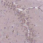 Anti-PNPLA5 Antibody