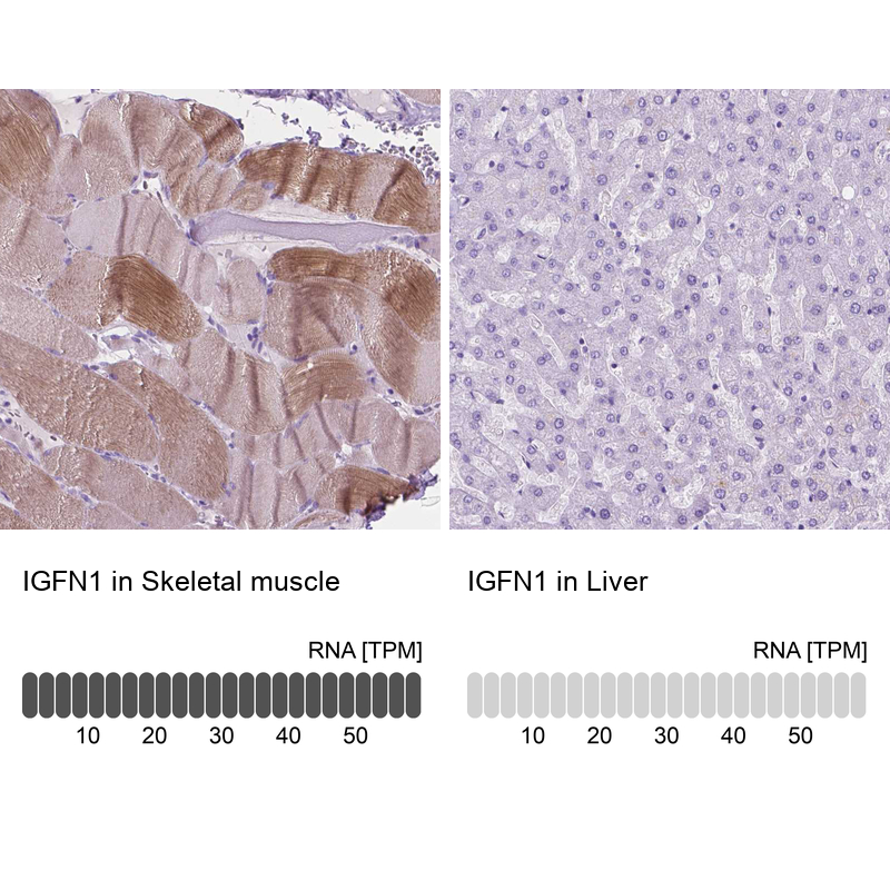 Anti-IGFN1 Antibody
