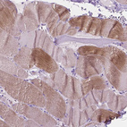 Immunohistochemical staining of human skeletal muscle shows moderate cytoplasmic positivity in myocytes.