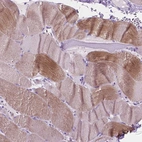 Immunohistochemical staining of human skeletal muscle shows moderate cytoplasmic positivity in myocytes.