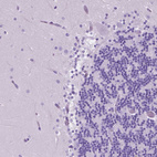 Immunohistochemical staining of human cerebellum shows no positivity in Purkinje cells as expected.