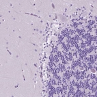 Immunohistochemical staining of human cerebellum shows no positivity in Purkinje cells as expected.