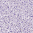 Immunohistochemical staining of human liver shows no positivity in hepatocytes as expected.