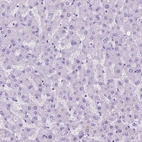 Immunohistochemical staining of human liver shows no positivity in hepatocytes as expected.
