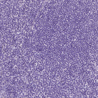 Immunohistochemical staining of human lymph node shows no positivity in non-germinal center cells as expected.