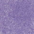 Immunohistochemical staining of human lymph node shows no positivity in non-germinal center cells as expected.