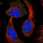 Immunofluorescent staining of human cell line HeLa shows localization to midbody ring.