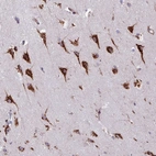 Immunohistochemical staining of human cerebral cortex shows strong granular cytoplasmic positivity in neurons.