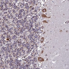 Immunohistochemical staining of human cerebellum shows moderate granular cytoplasmic positivity in Purkinje cells.