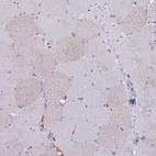 Immunohistochemical staining of human skeletal muscle shows weak positivity in myocytes.