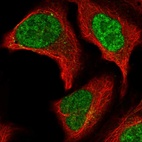 Immunofluorescent staining of human cell line U-2 OS shows localization to nucleoplasm.