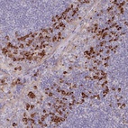 Anti-TRAPPC10 Antibody