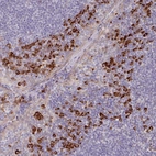 Anti-TRAPPC10 Antibody