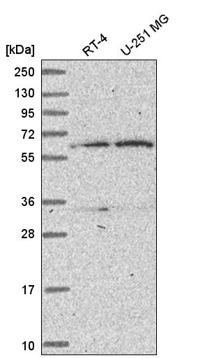 Anti-TBRG4 Antibody