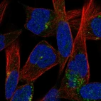 Immunofluorescent staining of human cell line RH-30 shows localization to the Golgi apparatus.