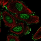 Immunofluorescent staining of human cell line PC-3 shows localization to nucleoplasm & plasma membrane.