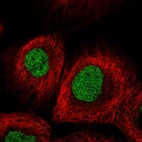 Immunofluorescent staining of human cell line A-431 shows localization to nucleus.