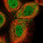 Immunofluorescent staining of human cell line A-431 shows localization to nucleoplasm & cytosol.