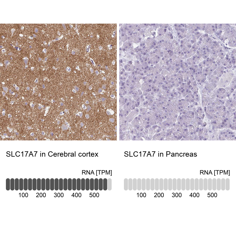 Anti-SLC17A7 Antibody