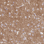 Immunohistochemical staining of human cerebral cortex shows moderate cytoplasmic positivity in neuropil.