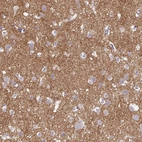 Immunohistochemical staining of human cerebral cortex shows moderate cytoplasmic positivity in neuropil.