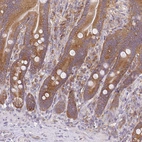 Immunohistochemical staining of human gastrointestinal shows moderate cytoplasmic positivity in glandular cells.