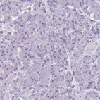 Immunohistochemical staining of human pancreas shows no positivity in exocrine glandular cells as expected.