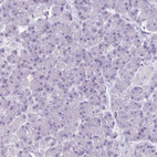 Anti-SLC17A7 Antibody