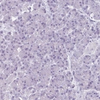 Immunohistochemical staining of human pancreas shows no positivity in exocrine glandular cells as expected.