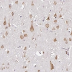 Immunohistochemical staining of human cerebral cortex shows moderate cytoplasmic positivity in neurons.