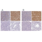 Immunohistochemical staining of human cerebellum, cerebral cortex, pancreas and testis using Anti-SLC17A7 antibody HPA050458 (A) shows similar protein distribution across tissues to independent antibody HPA063679 (B).