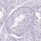 Immunohistochemical staining of human testis shows no positivity in cells in seminiferous ducts as expected.
