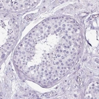 Immunohistochemical staining of human testis shows no positivity in cells in seminiferous ducts as expected.