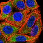 Immunofluorescent staining of human cell line MCF7 shows localization to cytosol & endoplasmic reticulum.