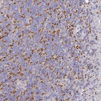 Immunohistochemical staining of human cerebellum shows strong cytoplasmic positivity in cells in granular layer.