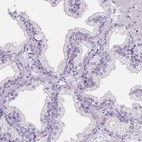 Immunohistochemical staining of human prostate shows low expression as expected.