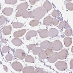 Immunohistochemical staining of human skeletal muscle shows high expression.