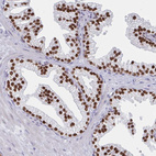 Immunohistochemical staining of human prostate shows strong nuclear positivity in glandular cells.