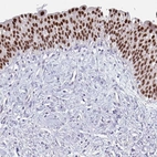 Immunohistochemical staining of human urinary bladder shows strong nuclear positivity in urothelial cells.