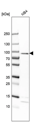 Anti-EPX Antibody